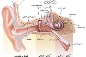 کاشت حلزون و کم شنوایی